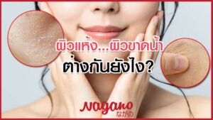 ผิวแห้ง