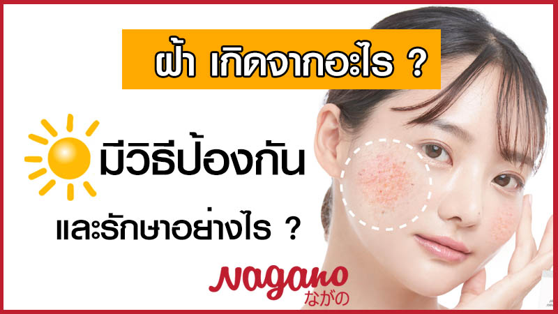 ฝ้า